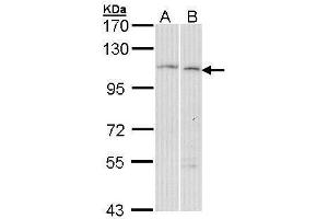 WB Image Sample (30 ug of whole cell lysate) A: Hela B: Molt-4 , 7. (GANAB antibody  (C-Term))