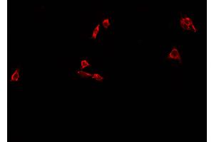 ABIN6273452 staining A549 cells by IF/ICC. (CD63 antibody  (Internal Region))