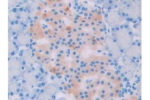 DAB staining on IHC-P; Samples: Rat Pancreas Tissue (UCP2 antibody  (AA 99-216))