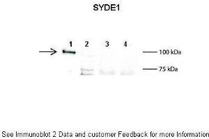 Lanes:   1: 2ug mouse SYDE1 transfected HEK293T lysate, 2: 15ug untransfected HEK293T lysate, 3: 100ug wild type mouse brain lysate, 4: 100ug SYDE1 knock-out mouse brain lysate  Primary Antibody Dilution:   1:500  Secondary Antibody:   Anti-rabbit L-chain HRP  Secondary Antibody Dilution:   1:10,000  Gene Name:   SYDE1  Submitted by:   Anonymous (SYDE1 antibody  (N-Term))
