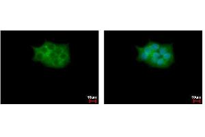 ICC/IF Image SCAP2 antibody [C2C3], C-term detects SKAP2 protein at cytoplasm by immunofluorescent analysis. (SKAP2 antibody  (C-Term))