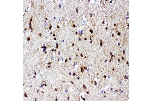 Anti- p73 antibody, IHC(P) IHC(P): Rat Brain Tissue (Tumor Protein p73 antibody  (AA 1-198))