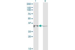 Western Blot analysis of RPP40 expression in transfected 293T cell line by RPP40 monoclonal antibody (M03), clone 1G8. (RPP40 antibody  (AA 295-363))