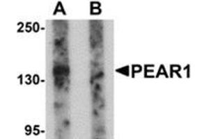 Western blot analysis of PEAR1 in rat kidney tissue lysate with PEAR1 antibody at 1 μg/ml in (A) the absence and (B) the presence of blocking peptide. (PEAR1 antibody  (C-Term))