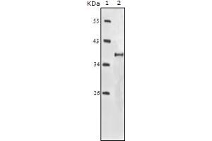 Western Blotting (WB) image for anti-Insulin-Like Growth Factor 1 Receptor (IGF1R) (truncated) antibody (ABIN2464067) (IGF1R antibody  (truncated))