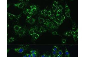 Immunofluorescence analysis of C6 cells using CYB5A Polyclonal Antibody at dilution of 1:100 (40x lens). (CYB5A antibody)