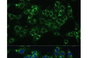 Immunofluorescence analysis of C6 cells using CYB5A Polyclonal Antibody at dilution of 1:100 (40x lens).