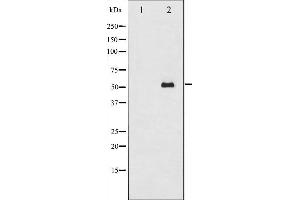 Western blot analysis of Smad2 expression in 293 whole cell lysates,The lane on the left is treated with the antigen-specific peptide.