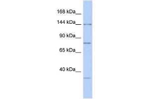 Western Blotting (WB) image for anti-Drosha, Ribonuclease Type III (DROSHA) (Middle Region) antibody (ABIN2779039)
