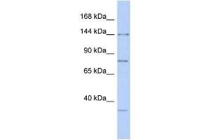 WB Suggested Anti-RNASEN Antibody Titration:  0. (DROSHA antibody  (Middle Region))
