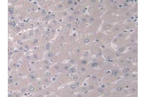 IHC-P analysis of Human Liver Tissue, with DAB staining. (IGFBP4 antibody  (AA 22-258))