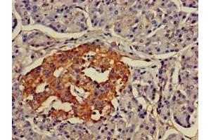 Immunohistochemistry of paraffin-embedded human pancreatic tissue using ABIN7158379 at dilution of 1:100 (LMX1A antibody  (AA 9-86))