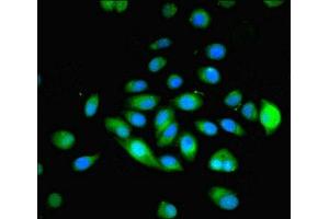 Immunofluorescent analysis of A549 cells using ABIN7160482 at dilution of 1:100 and Alexa Fluor 488-congugated AffiniPure Goat Anti-Rabbit IgG(H+L) (MYADM antibody  (AA 1-40))