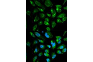 Immunofluorescence analysis of HepG2 cell using KIR2DL3 antibody. (KIR2DL3 antibody)