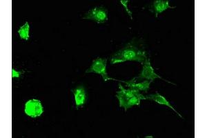 Immunofluorescent analysis of MCF-7 cells using ABIN7151009 at dilution of 1:100 and Alexa Fluor 488-congugated AffiniPure Goat Anti-Rabbit IgG(H+L) (STUB1 antibody  (AA 1-48))
