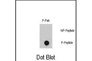 Dot blot analysis of Phospho-RAF1- polyclonal antibody (ABIN389732 and ABIN2839672) on nitrocellulose membrane. (RAF1 antibody  (pSer471))