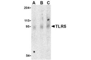 Image no. 1 for anti-Toll-Like Receptor 5 (TLR5) (Middle Region) antibody (ABIN265143) (TLR5 antibody  (Middle Region))