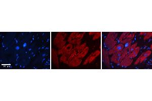 Immunohistochemistry (IHC) image for anti-GTPase Activating Protein (SH3 Domain) Binding Protein 1 (G3BP1) (N-Term) antibody (ABIN2780222)