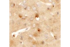 Immunohistochemistry (IHC) image for anti-Coiled-Coil Domain Containing 141 (CCDC141) (N-Term) antibody (ABIN1031303) (CCDC141 antibody  (N-Term))
