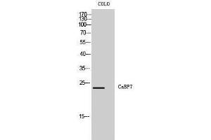 Western Blotting (WB) image for anti-Calcium Binding Protein 7 (CABP7) (N-Term) antibody (ABIN3183608) (CABP7 antibody  (N-Term))
