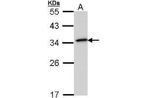 WB Image Sample (30 ug of whole cell lysate) A: 293T 12% SDS PAGE antibody diluted at 1:1000 (NQO1 antibody  (Center))