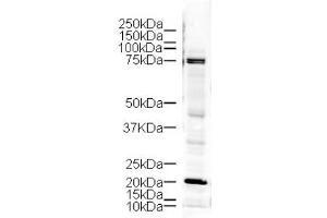 Image no. 1 for anti-LIM Domain Kinase 1 (LIMK1) (AA 630-647) antibody (ABIN401293) (LIM Domain Kinase 1 antibody  (AA 630-647))