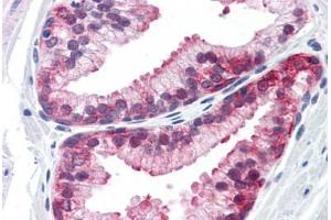 Human Prostate: Formalin-Fixed, Paraffin-Embedded (FFPE) (PAX2A antibody  (AA 194-304))