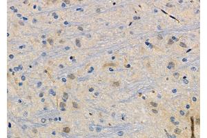 ABIN6266129 and ABIN6272494 at 1/100 staining Rat brain tissue by IHC-P. (ZNF462 antibody  (Internal Region))
