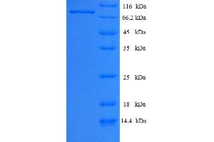 SDS-PAGE (SDS) image for NCAP (AA 1-560), (full length) protein (His-SUMO Tag) (ABIN5711067) (NCAP (AA 1-560), (full length) protein (His-SUMO Tag))