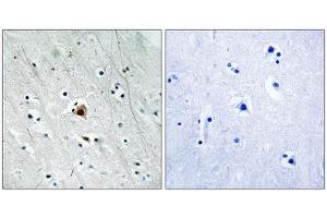 Immunohistochemistry analysis of paraffin-embedded human brain tissue using MAPKAPK2 (Phospho-Ser272) antibody. (MAPKAP Kinase 2 antibody  (pSer272))