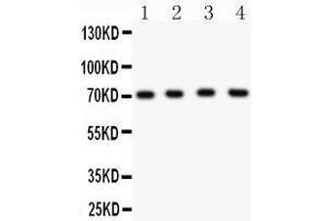 Anti- KCND1 Picoband antibody, Western blotting All lanes: Anti KCND1  at 0. (KCND1 antibody  (AA 442-647))