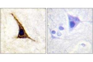 Immunohistochemistry (IHC) image for anti-Adrenergic, beta-2-, Receptor, Surface (ADRB2) (AA 331-380), (pSer355) antibody (ABIN1531482)