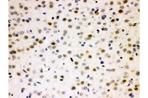 IHC testing of FFPE rat brain with CDC25B antibody. (CDC25B antibody  (AA 119-248))