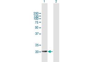 Western Blot analysis of APRT expression in transfected 293T cell line by APRT MaxPab polyclonal antibody. (APRT antibody  (AA 1-180))
