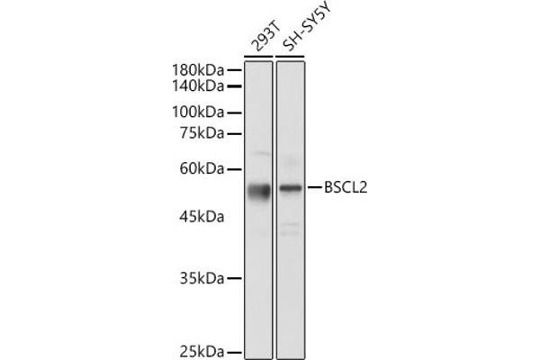 BSCL2 抗体  (AA 50-150)