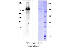 Image no. 1 for Chloride Channel Accessory 1 (CLCA1) (AA 22-913) protein (rho-1D4 tag,His tag) (ABIN3137110) (CLCA1 Protein (AA 22-913) (rho-1D4 tag,His tag))