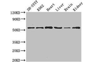 Western Blot Positive WB detected in: SH-SY5Y whole cell lysate, K562 whole cell lysate, Mouse heart tissue, Mouse liver tissue, Mouse brain tissue, Mouse kidney tissue All lanes: SLC16A9 antibody at 3. (SLC16A9 antibody  (AA 185-304))