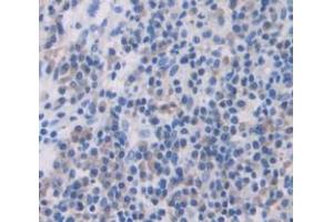 Figure. (ZFAND6 antibody  (AA 19-208))