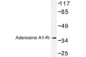Image no. 1 for anti-Adenosine A1 Receptor (ADORA1) antibody (ABIN317738) (ADORA1 antibody)