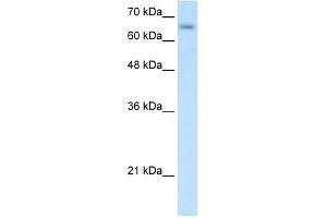WB Suggested Anti-SLC39A12 Antibody Titration:  0. (SLC39A12 antibody  (N-Term))