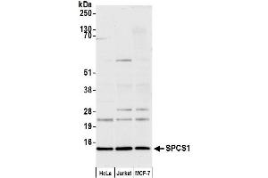 Western Blotting (WB) image for anti-Signal Peptidase Complex Subunit 1 (SPCS1) (AA 52-102) antibody (ABIN7452841)