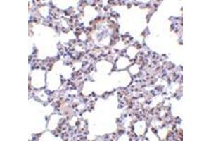 Immunohistochemistry of TRPC6 in mouse lung tissue with this product at 10 μg/ml. (TRPC6 antibody  (N-Term))