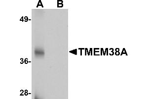 Western blot analysis of TMEM38A in rat skeletal muscle tissue lysate with TMEM38A antibody at 1 µg/mL in (A) the absence and (B) the presence of blocking peptide. (TMEM38A antibody  (C-Term))
