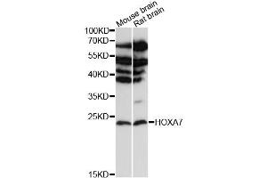 Western blot analysis of extracts of various cell lines, using HOXA7 antibody (ABIN6290494) at 1:3000 dilution.