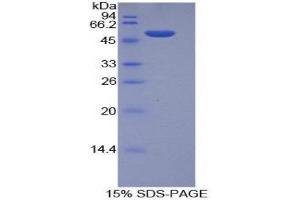 SDS-PAGE (SDS) image for Integrin, alpha 6 (ITGA6) (AA 903-1073) protein (His tag,GST tag) (ABIN2123035)