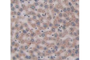 Immunohistochemistry (IHC) image for anti-Serpin Peptidase Inhibitor, Clade G (C1 Inhibitor), Member 1 (SERPING1) (AA 406-476) antibody (ABIN1858182)
