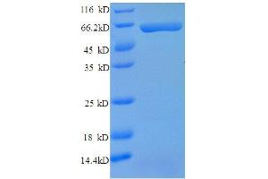 SDS-PAGE (SDS) image for Carbonic Anhydrase IX (CA9) (AA 64-399), (partial) protein (GST tag) (ABIN1046760)