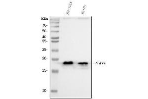 Western blot analysis of HMGN2 using anti-HMGN2 antibody (ABIN6719576). (HMGN2 antibody)