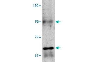 Western blot analysis of RUSC1 in A-20 cell lysate with RUSC1 polyclonal antibody  at 1 ug/mL . (RUSC1 antibody  (C-Term))