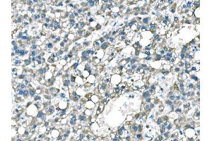 IHC analysis of B Raf/BRAF using anti-B Raf/BRAF antibody (ABIN3043761).